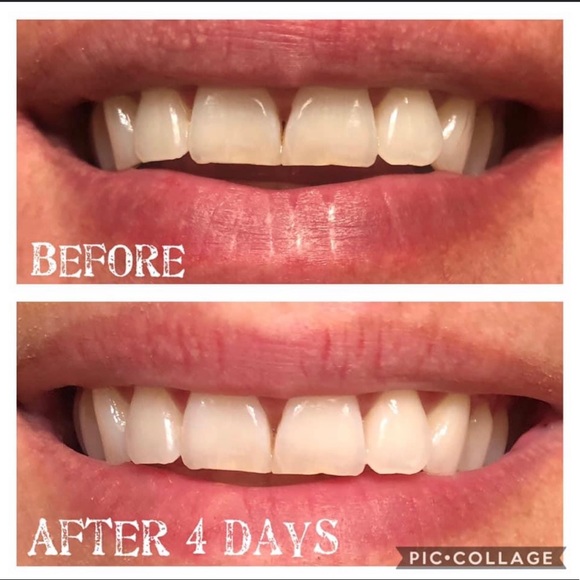 (1) AP24 Whitening toothpaste - Picture 3 of 3